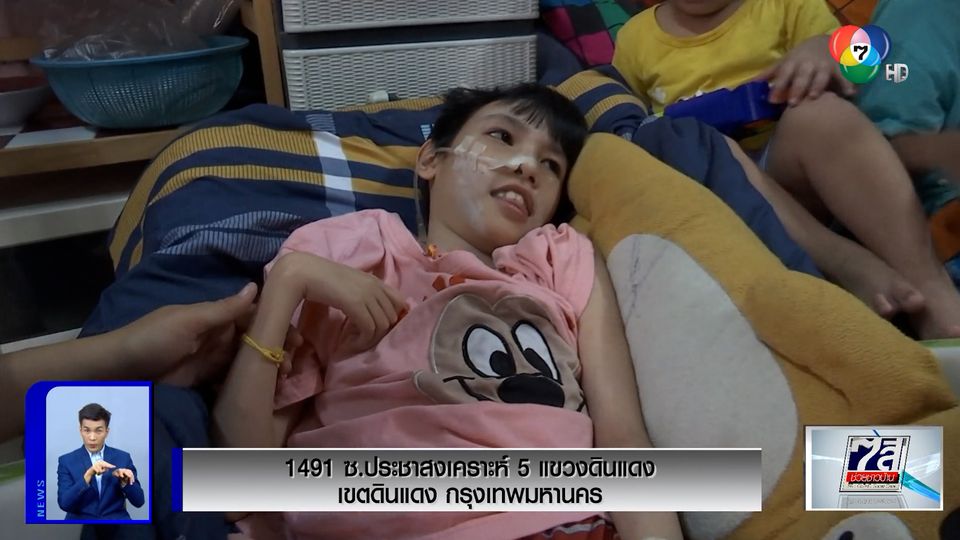 ภานุรัจน์ฟอร์ไลฟ์ : เวทนา น้องนานา พิการทางสมอง