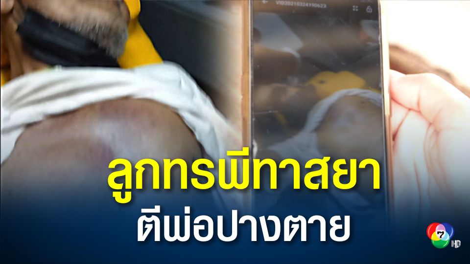 ลูกทรพีคลั่งยาบ้า ทำร้ายพ่อโคม่า