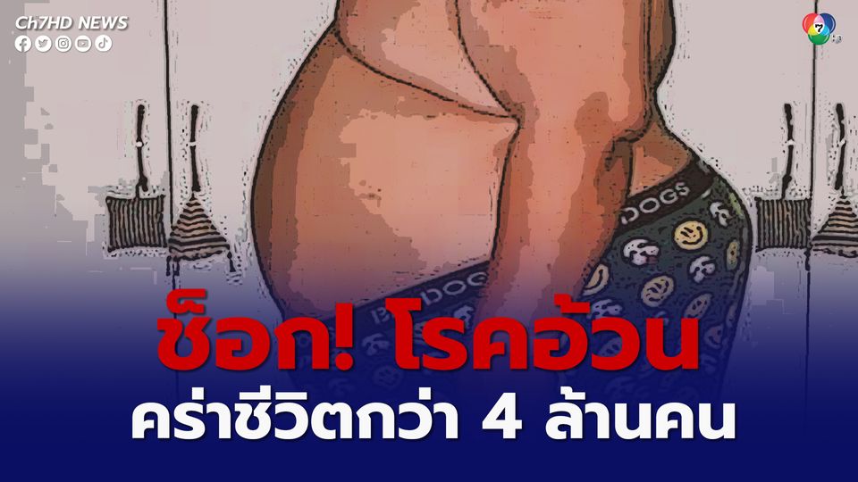 กรมควบคุมโรค เผยข้อมูลสุดช็อก โรคอ้วน คร่าชีวิตมากกว่า 4 ล้านคน แนะหากิจกรรมทางกายทำเพิ่ม กินผักเยอะขึ้น