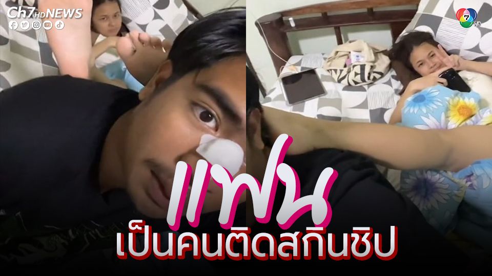 มีแฟนเป็นคนติดสกินชิป ต้องขอโดนตัวสักนิดนึงก็ยังดี