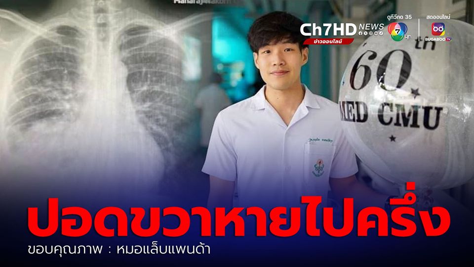 หมอแล็บแพนด้า เผยภาพปอดหมอกฤตไท ปอดข้างขวาหายไปครึ่งหนึ่ง