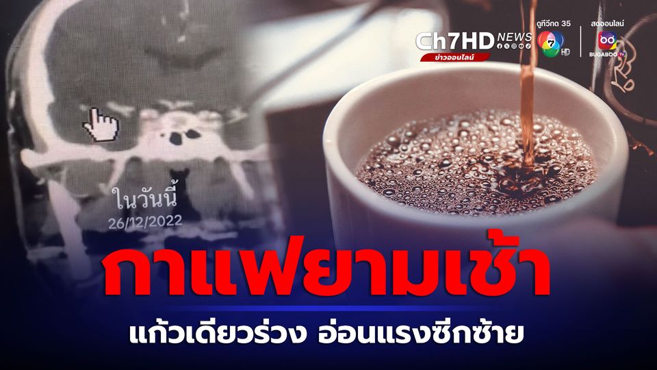อายุ 49 ปี ดื่มกาแฟตอนเช้า แก้วเดียวอ่อนแรง เส้นเลือดสมองอุดตัน