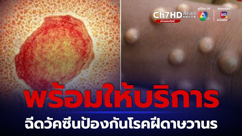 วัคซีนป้องกันโรคฝีดาษวานรพร้อมให้บริการฉีดแล้วที่สถานเสาวภาและศูนย์วิจัยโรคเอดส์ สภากาชาดไทย ในวันที่ 29 มกราคม 2567