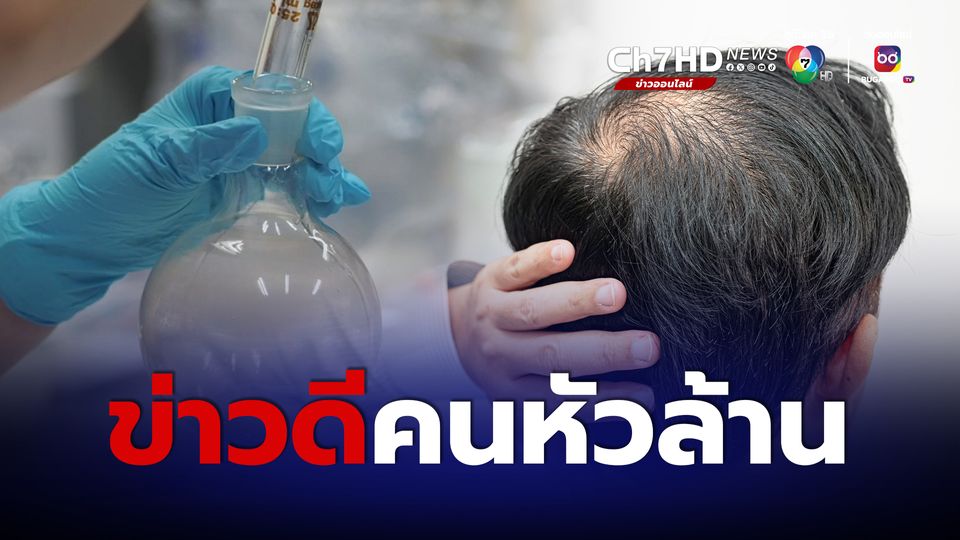 ข่าวดีคนหัวล้าน นักวิจัยเภสัช มช. คิดค้นสารกระตุ้นผมให้งอกใหม่ 80% ภายใน 3 เดือน