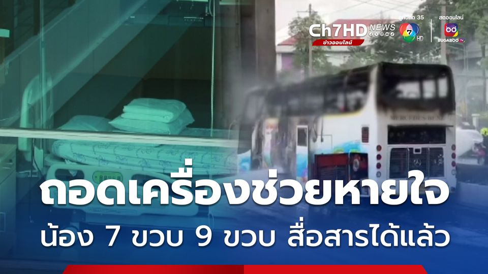 น้อง 7 ขวบ 9 ขวบ ถอดเครื่องช่วยหายใจ แผลไฟไหม้ไม่พบการติดเชื้อ