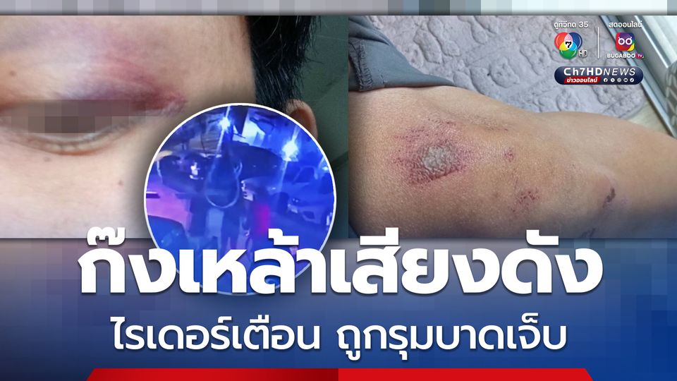 วัยรุ่นก๊งเหล้าเสียงดัง ไรเดอร์หนุ่มเข้าไปเตือน ถูกรุมบาดเจ็บ ต้องย้ายคอนโดหนี