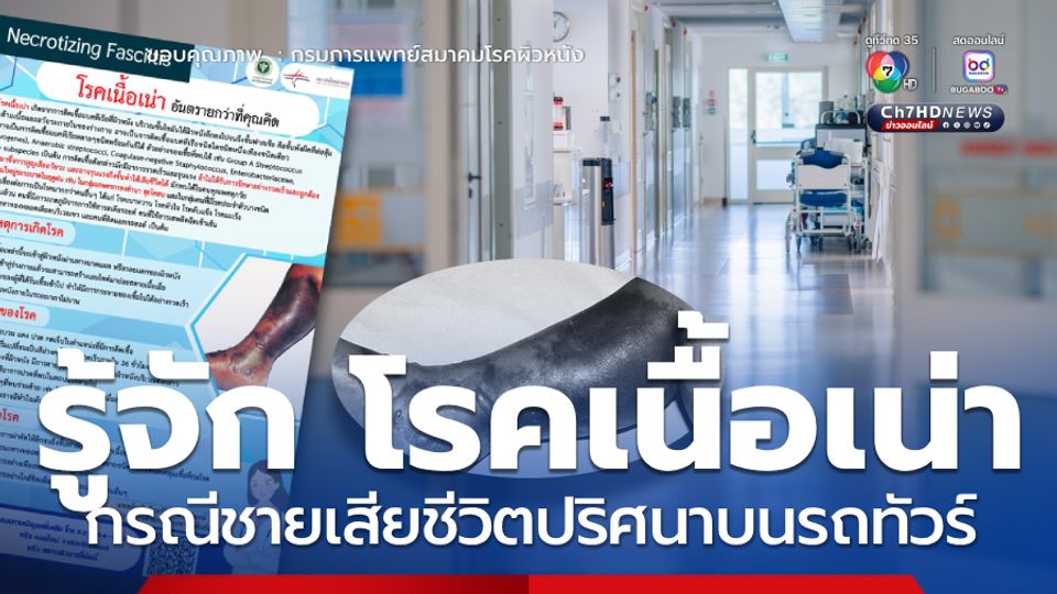 รู้จักโรคแบคทีเรียกินเนื้อคน กรณีชายเสียชีวิตปริศนาบนรถทัวร์