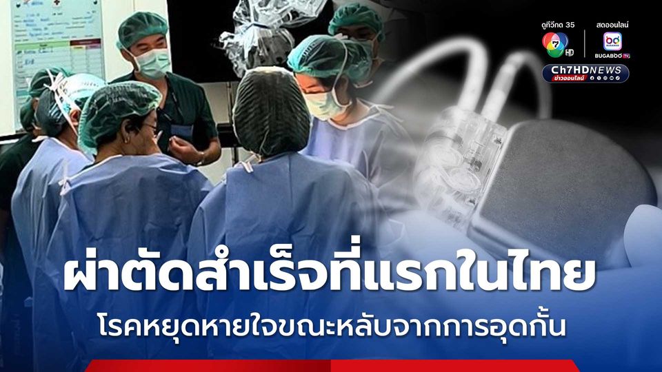 รพ.จุฬาฯ ผ่าตัดสำเร็จแห่งแรกในไทย รักษาโรคหยุดหายใจขณะหลับจากการอุดกั้น 