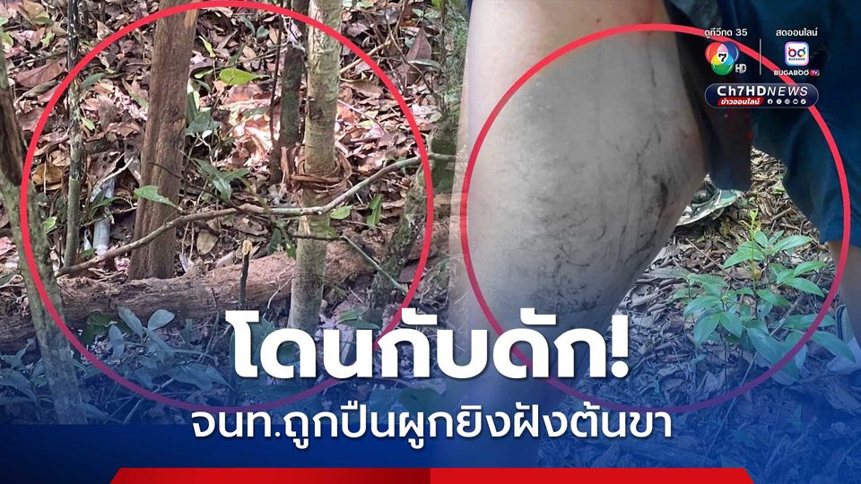 โดนกับดัก จนท.ถูกปืนผูกยิงฝังต้นขา