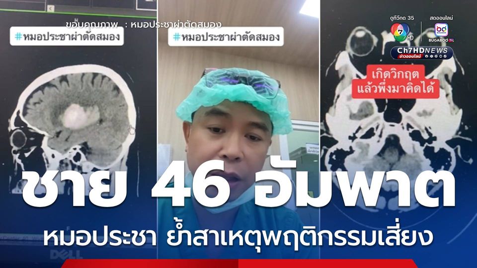 หมอประชา ย้ำสาเหตุพฤติกรรมเสี่ยง อัมพาตเพราะเส้นเลือดสมองแตก