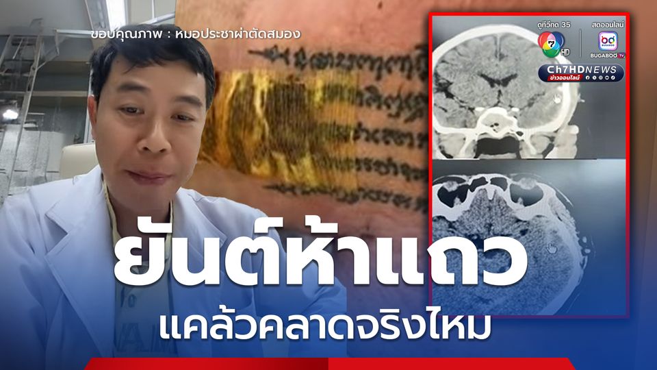 หมอประชายกเคสผู้ป่วย ปาฏิหารย์ยันต์ห้าแถว แคล้วคลาดจริงไหม