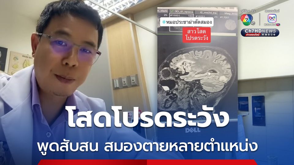 โสดโปรดระวัง สมองตายหลายตำแหน่ง ผลตรวจพบมะเร็งรังไข่