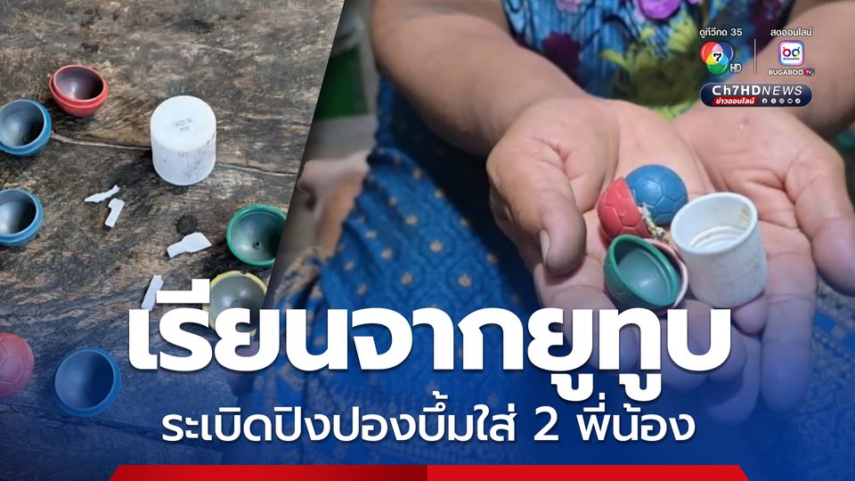 สองพี่น้องแอบเอาระเบิดปิงปองพ่อไปจุดเล่น ระเบิดใส่มือ-หน้าเละทั้งคู่ อ้างเรียนกับยูทูป