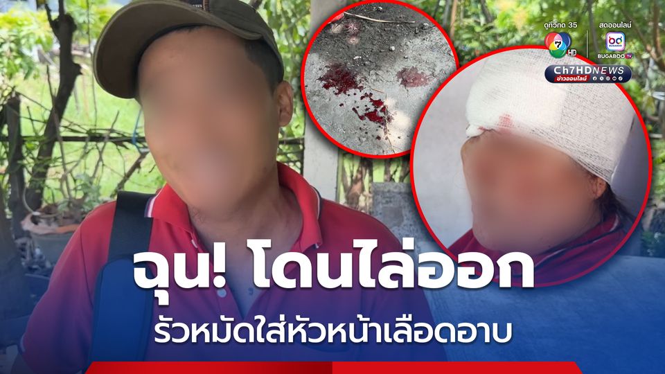 หนุ่มเมียนมา ฉุน! อ้างโดนต่อว่า-ไล่ออก รัวหมัดใส่หัวหน้าหญิงวัย 50 ปี เลือดอาบ