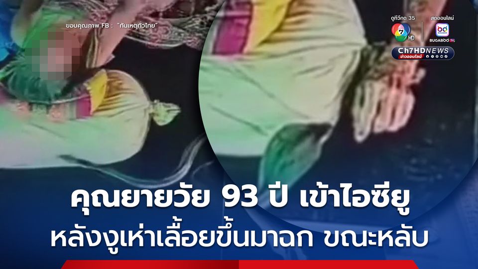 งูเห่าเลื้อยฉกยายวัย 93 ปี ขณะนอนหลับอยู่บนเตียง โดยฉกที่นิ้วมือ จำนวน 3 ครั้ง อาการสาหัส