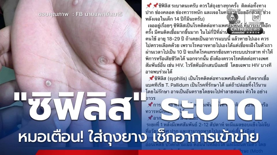 หมอเตือน! ซิฟิลิส ระบาด ชี้ ควรใส่ถุงยาง เช็กอาการเข้าข่าย