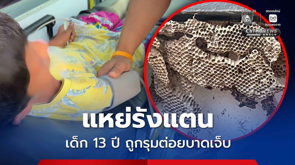 อุทาหรณ์ แหย่รังแตน เด็ก 13 ปี ถูกรุมต่อยบาดเจ็บ