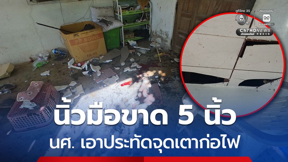 นิ้วมือขาด 5 นิ้ว นศ. เอาประทัดจุดเตาก่อไฟ ระเบิดใส่คามือ