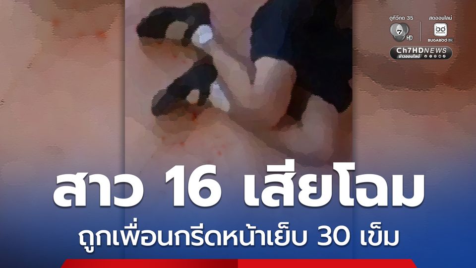 สาว 16 เสียโฉม ถูกเพื่อนกรีดหน้าเย็บ 30 เข็ม