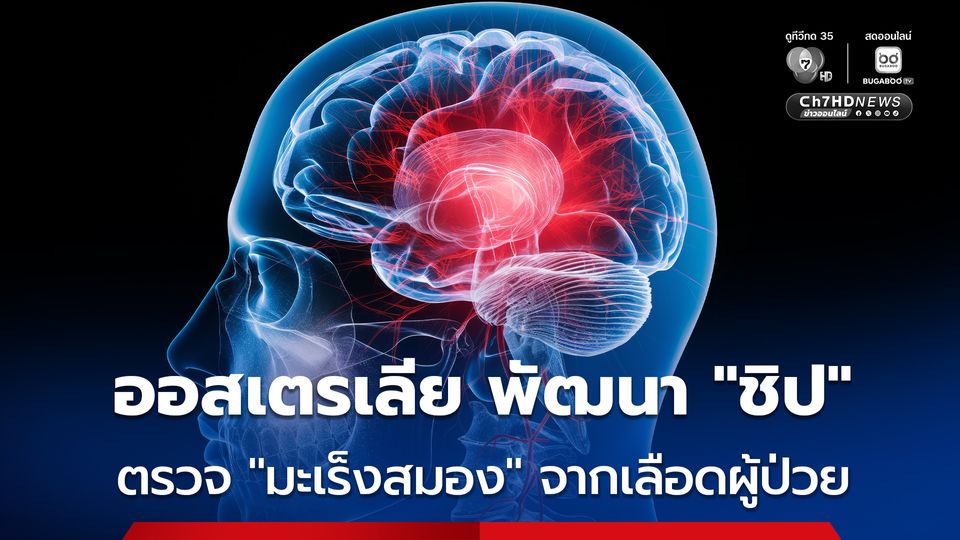 ออสเตรเลีย พัฒนา “ชิป” ตรวจมะเร็งสมอง จากเลือดของผู้ป่วย ลดการตัดชิ้นเนื้อ-ตรวจ MRI 