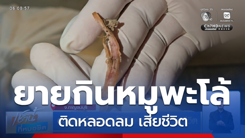 อุทาหรณ์ ! หมูพะโล้ติดหลอดลม เสียชีวิต