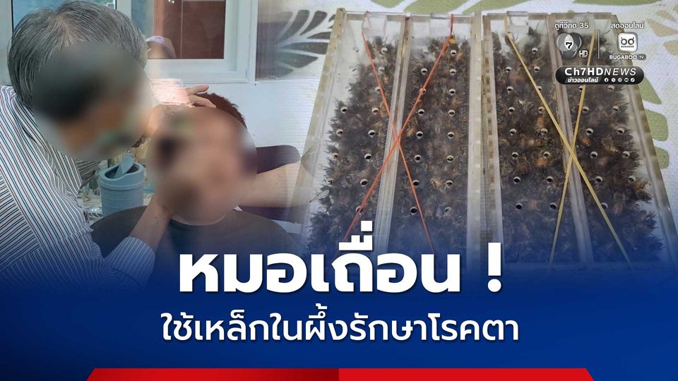 บุกรวบหมอเถื่อน ! ใช้เหล็กในผึ้งรักษาโรคตาพร่า ตามัว