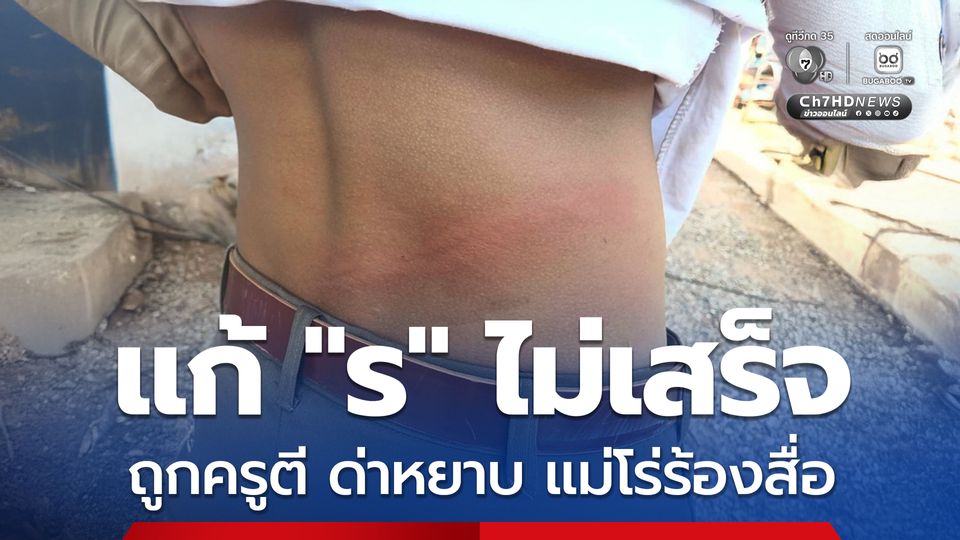 แม่เดือดลูกชายถูกครูตีจนเป็นแผล ซ้ำด่าด้วยคำหยาบ