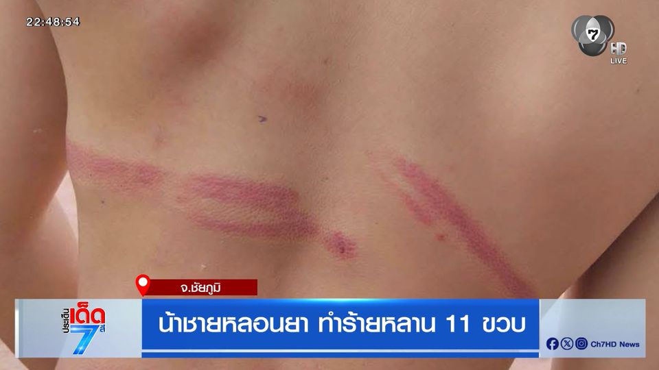 น้าชายหลอนยา ทำร้ายหลาน 11 ขวบ