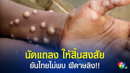 สธ.นัดแถลงผลตรวจ ผู้เข้าข่ายสงสัยติดเชื้อโรคฝีดาษลิง 3 ราย ยันไทยไม่พบผู้ป่วยฝีดาษลิง
