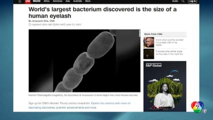 พบแบคทีเรียที่ใหญ่ที่สุด เทียบเท่าขนตามนุษย์