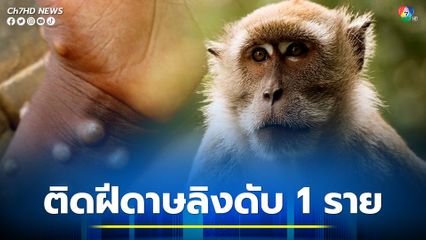 อาร์เจนตินาพบผู้ติดเชื้อฝีดาษลิง เสียชีวิตแล้วเป็นรายแรก