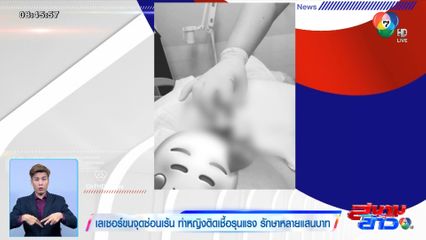 เลเซอร์ขนจุดซ่อนเร้น ทำหญิงติดเชื้อรุนแรง รักษาหลายแสนบาท