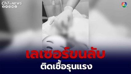 สาวเลเซอร์ขนจุดซ่อนเร้น เกิดอาการแพ้ติดเชื้อรุนแรง
