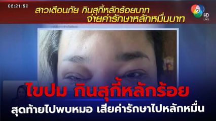 ไขปมกินสุกี้หลักร้อยบาท จ่ายค่ารักษาหลักหมื่นบาท