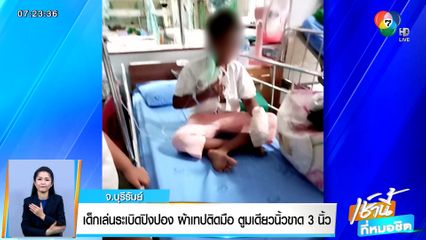 เด็กเล่นระเบิดปิงปอง ผ้าเทปติดมือ ตูมเดียวนิ้วขาด 3 นิ้ว