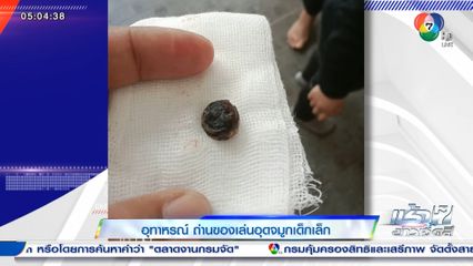 อุทาหรณ์ ถ่านของเล่นอุดจมูกเด็กเล็ก