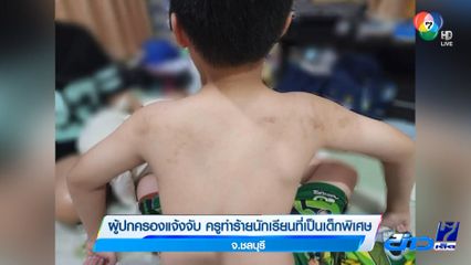 ผู้ปกครองแจ้งจับ ครูทำร้ายนักเรียนที่เป็นเด็กพิเศษ จ.ชลบุรี