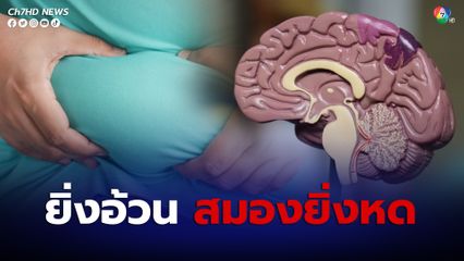 ความอ้วน ไม่ใช่แค่หุ่นไม่ดีไม่สวยไม่หล่อ แต่มีผล “สมองหดตัว” สมองเสื่อมเร็วขึ้น