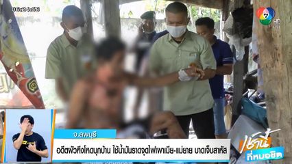 อดีตผัวหึงโหดบุกบ้าน ใช้น้ำมันราดจุดไฟเผาเมีย-แม่ยาย บาดเจ็บสาหัส