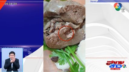 ภาพเป็นข่าว : อ้วกแทบพุ่ง สาวเจอหนอนในตับไก่