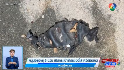 หนูน้อยอายุ 6 ขวบ เปิดกระเป๋าเกิดระเบิดใส่ หวิดมือขาด จ.ฉะเชิงเทรา