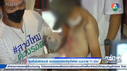 รุ่นพี่เล่นพิเรนทร์ ราดแอลกอฮอล์จุดไฟเผา ด.ช.อายุ 11 ขวบ