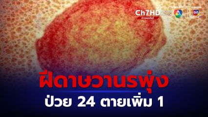 ฝีดาษวานรป่วยพุ่ง ติดเชื้อ 24 คน ตายเพิ่ม 1 คน