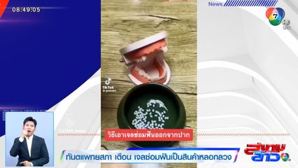 ทันตแพทยสภา เตือน เจลซ่อมฟันเป็นสินค้าหลอกลวง