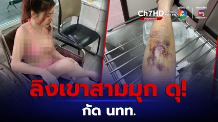 สาวร้อง ลิงเขาสามมุกกัดขาเหวอะ