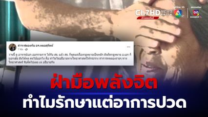 วิทยาศาสตร์ตอบได้ ทำไม อ.เอกฝ่ามือพลังจิต รักษาแต่อาการปวด-สายตา