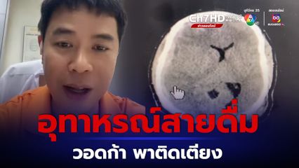 วอดก้าพาติดเตียง หมอเตือนสายดื่ม เมาล้มทิ้งตัวแรงเลือดไหลหยุดยาก