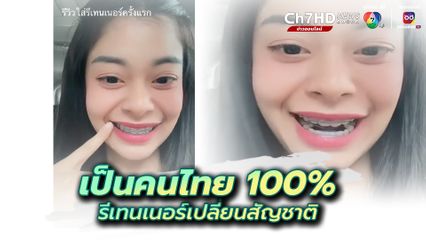 ทั้งเห็นใจ ทั้งขำ รีเทนเนอร์เปลี่ยนสัญชาติ สาวรีวิวปัญหาการใช้ชีวิตของคนอยากสวย จัดฟันแล้วใส่รีเทนเนอร์ ทำให้พูดไม่ชัด