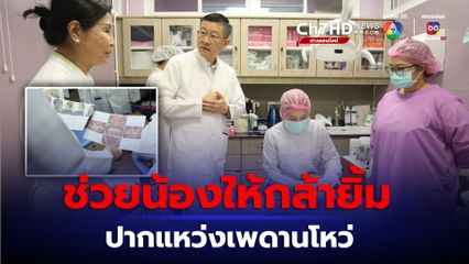 ปากแหว่งเพดานโหว่ บัตรทองรักษาตั้งแต่แรกเกิด 
