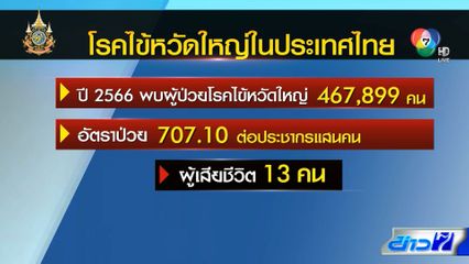 โรคไข้หวัดใหญ่ มาแรง ป่วยทั่วประเทศ 4 แสนกว่าคน